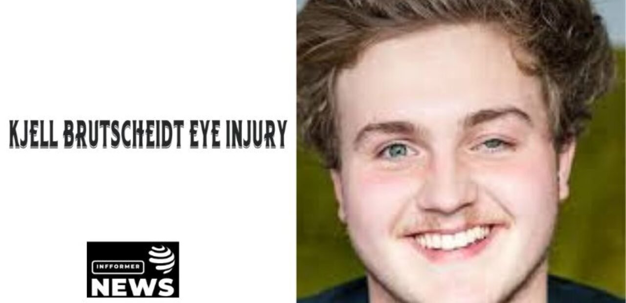 Kjell Brutscheidt Eye Injury